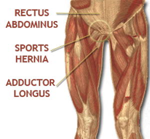 Sports Hernia Anatomy